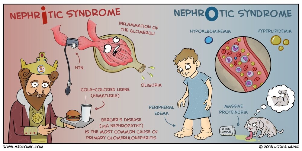 Nephritic vs nephrotic syndrome.
