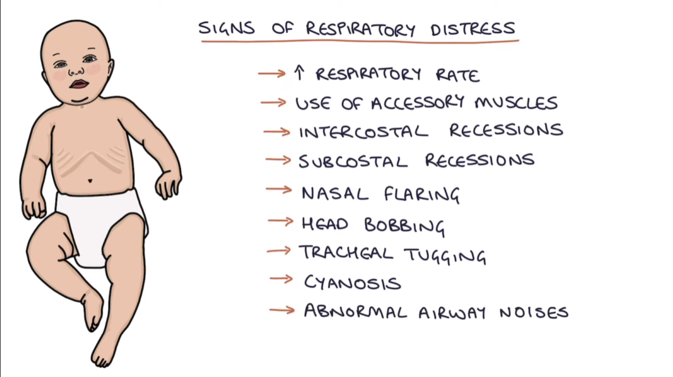 sings-of-respiratory-distress-in-infants.png