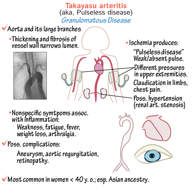 takayasu-arteritis.png